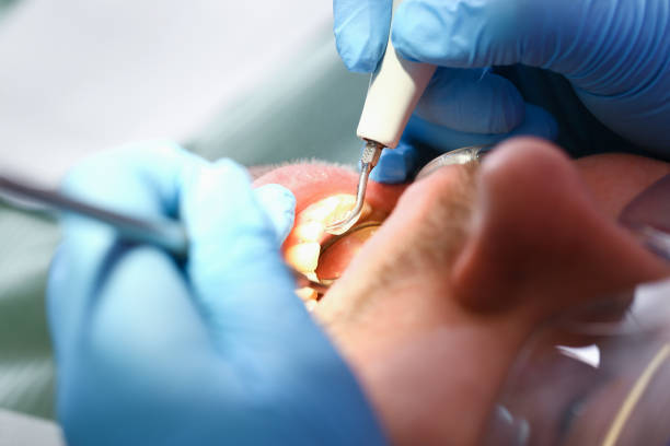 Fast & Reliable Emergency Dental Services in HI
